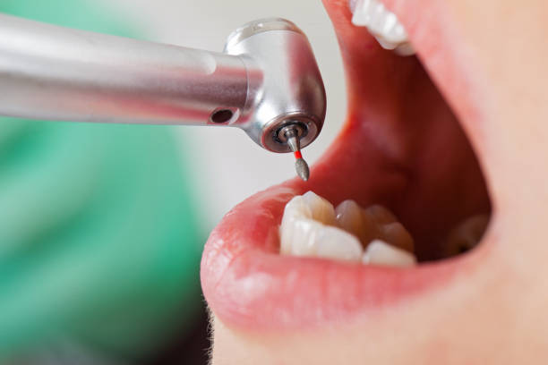 Best Mobile Emergency Dentist in Federal Y, WA